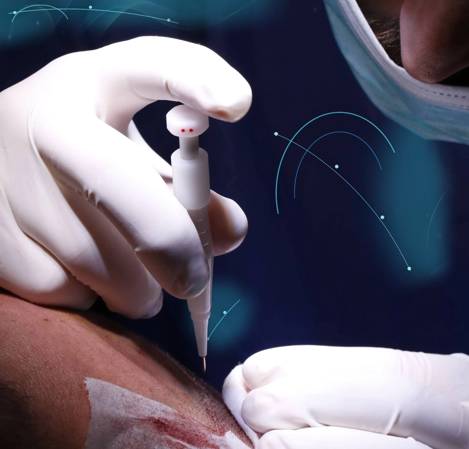 Doctor examining a patient before hair transplantation